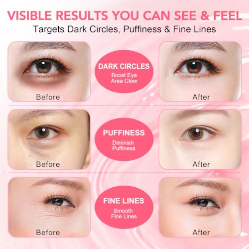 LUCKY CAT PDRN Collagen Eye Patches for Dark Circles & Puffiness (60 Ct)