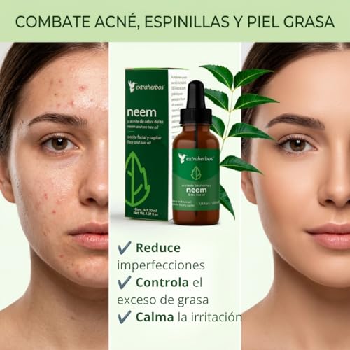 Pure Neem Oil with Tea Tree - Anti-Acne Face Oil, 1 fl oz