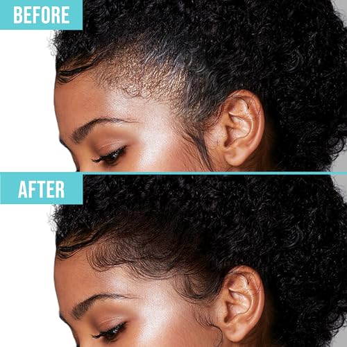 KISS Maximum Hold Edge Fixer - Non-Greasy Gel with Biotin B7, Pineapple Scent, 3.38 oz