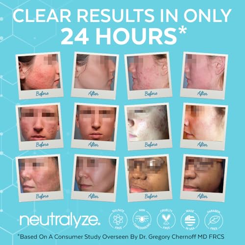 Neutralyze Mandelic Acid Face Wash with 2% Salicylic - Gentle Acne Cleanser 5 fl oz