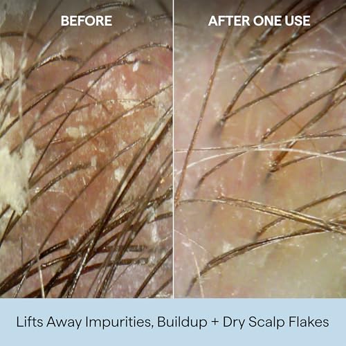 Briogeo Scalp Revival Charcoal + Coconut Oil Micro-Exfoliating Shampoo | Sulfate-Free Scalp Scrub for Dry, Itchy, or Oily Scalp | Detoxifying & Hydrating | Vegan & Cruelty Free