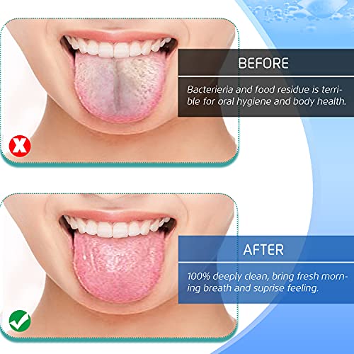 Stainless Steel Tongue Scraper Set - 4PCS Medical Grade Oral Hygiene