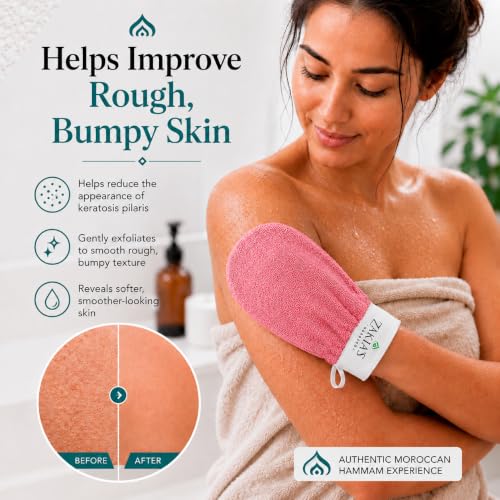 frank body Glycolic Acid Body Scrub | Fights KP & Breakouts, Spots & Tighten Pores | Reduces Acne with Niacinamide & Soothes with Witch Hazel | Glycolic Acid & Pumice | 8.82 oz | Pack of 1