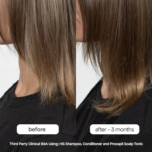 BONDIBOOST Procapil Scalp Treatment [4.23 fl oz], Daily Leave In Treatment for Thinning Hair + Anchor Hair, Scalp Serum for Thicker Hair with Procapil, Rosemary & Biotinoyl Tripeptide-1, Sulfate-Free