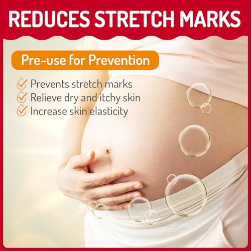 Stretch Mark Lotion for Pregnancy - 10.1 Fl Oz Body Care