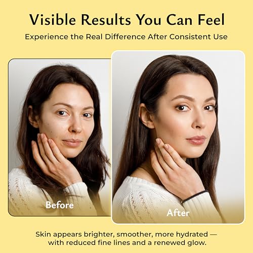 Hydrating Collagen Face Mask - 4-Pack with Hyaluronic Acid & Amino Acids