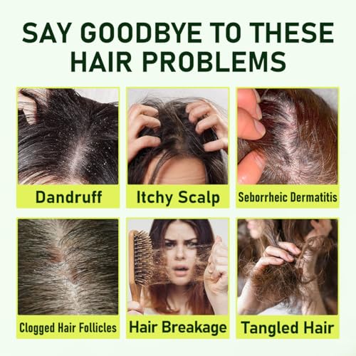 Follicle Shampoo 10.14 Fl Oz - Anti-Dandruff for Itchy Scalp Relief