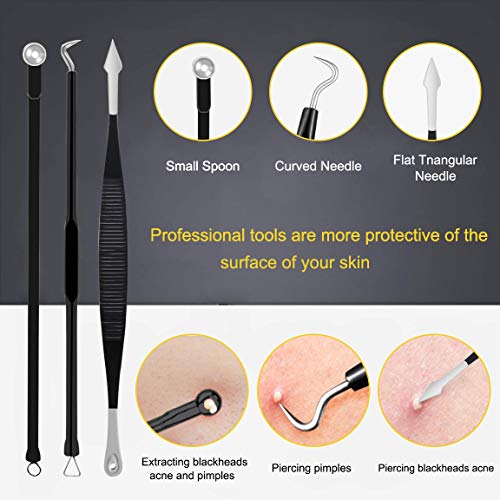 Boxoyx 10-Piece Stainless Steel Pimple Popper & Blackhead Remover Kit
