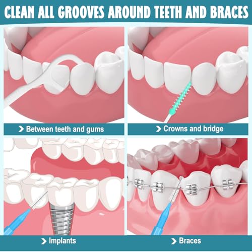 450-Piece Interdental Brush and Floss Pick Kit for Braces and Teeth
