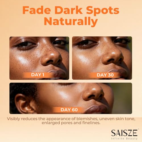 SAISZE Kojic Acid & Turmeric Dark Spots Remover Soap Bars - Brightening & Hyperpigmentation Treatment, 2 x 4oz
