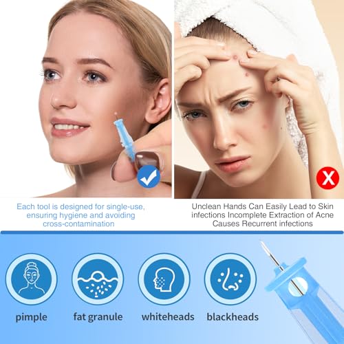 Sterile Pimple Needle Kit - 80 Ultra-Fine Acne Needles & 108 Stickers