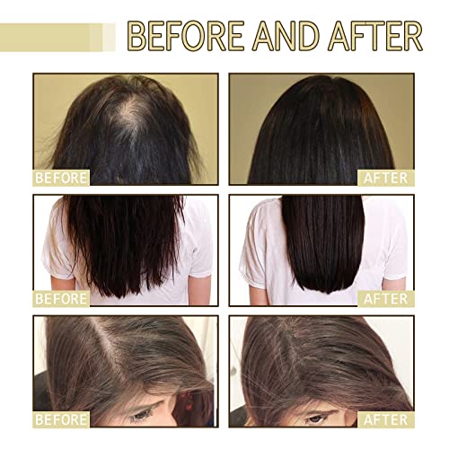 Deuiosna Colorless Natural Hair Growth Oil 2PC with Rosemary Scent for Damaged & Thin Hair