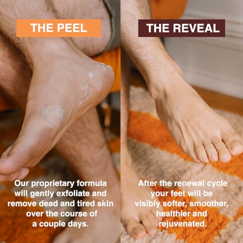 FEETS Foot Peel Mask - Exfoliating Treatment for Cracked Heels (2-Pack)
