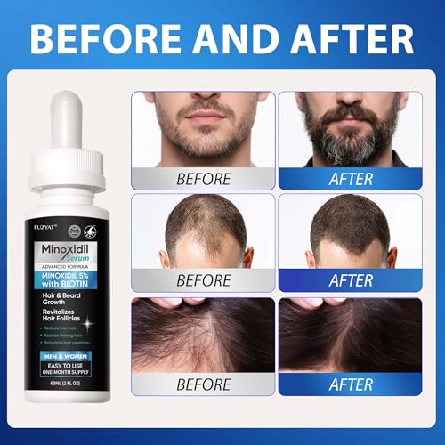 5% Minoxidil for Men, Minoxidil for Women Hair Growth Treatment, Beard Growth Serum, Biotin & Castor Oil Enriched,Strengthens Weak Roots, Repairs Thinning Hair (120ml)