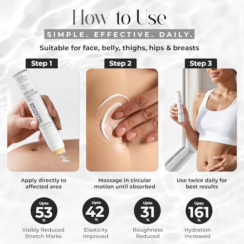 StretchMarkers Therapy Stretch Mark Cream ? Visibly Reduces and Treats, Stretch Marks Removal with Retinol, Hyaluronic Acid, Bioactive Peptides & 3D Stem Cell Technology, 1 fl oz