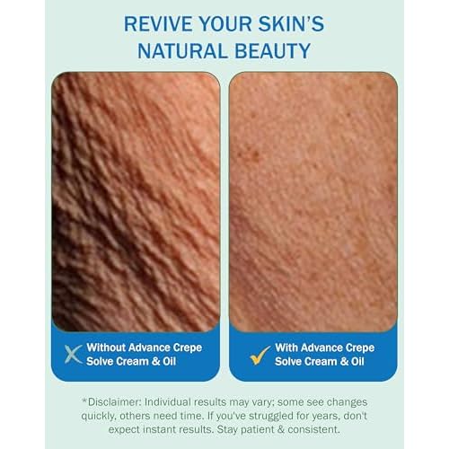 e70 Crepe Skin Erase Cream Set (2 Pk, 4 Fl Oz each) - with Natural Oils, Licorice Root & Chamomile Extract - Crepey Skin Tightening and Firming Body Cream, Made in USA