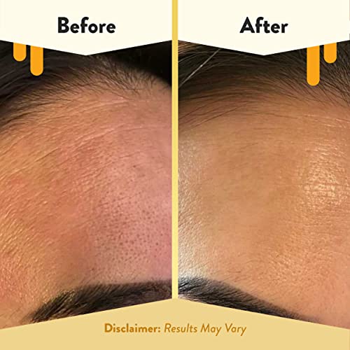Eczema Honey Oatmeal Facial Cleanser - Natural Face Wash for Sensitive Skin (6 Oz)