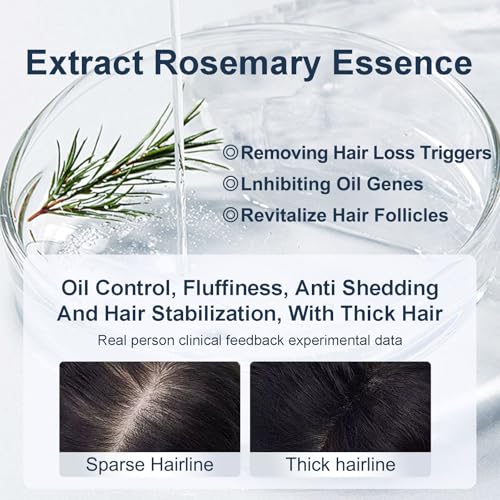 Tgideas Rosemary Hair Growth Shampoo with Biotin for Thinning Hair