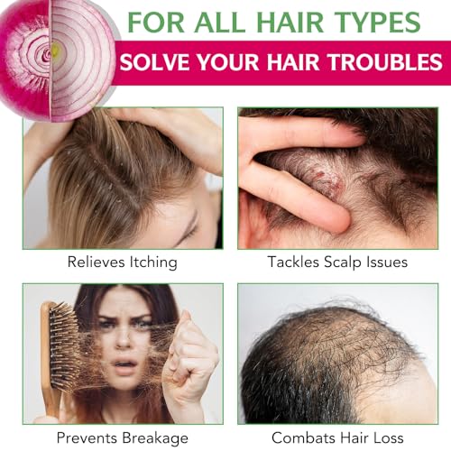 Onion Biotin & Rosemary Shampoo Set for Thinning Hair