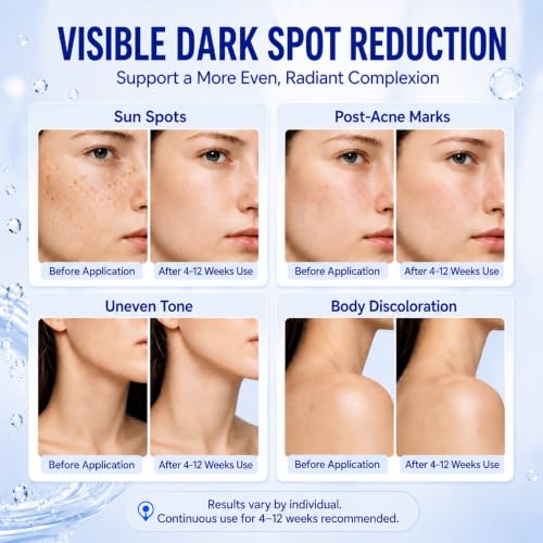 HANYWIL Dark Spot Corrector Serum with Kojic Acid & Alpha Arbutin, 0.5 Fl Oz