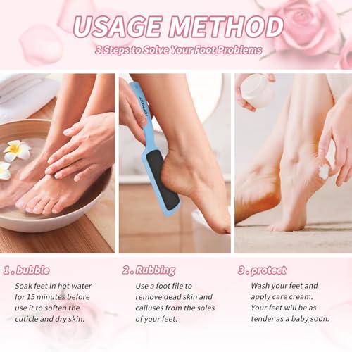 Topmeet Dual Sided Foot File - Callus Remover for Smooth Feet