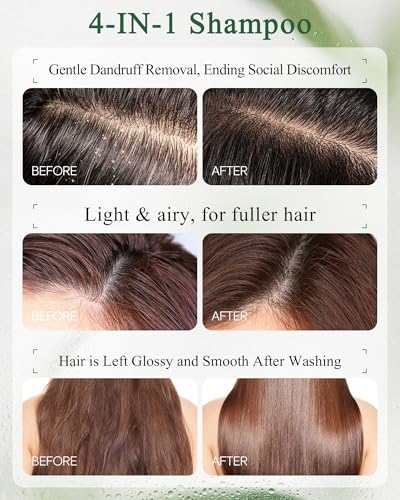 Mugwort Scalp Detox Shampoo for Sensitive Scalp - 1% Salicylic Acid