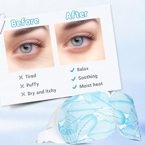 MOEASEii Steam Eye Mask for Dry Eyes - Self-Heating Warm Compress, 40 Packs