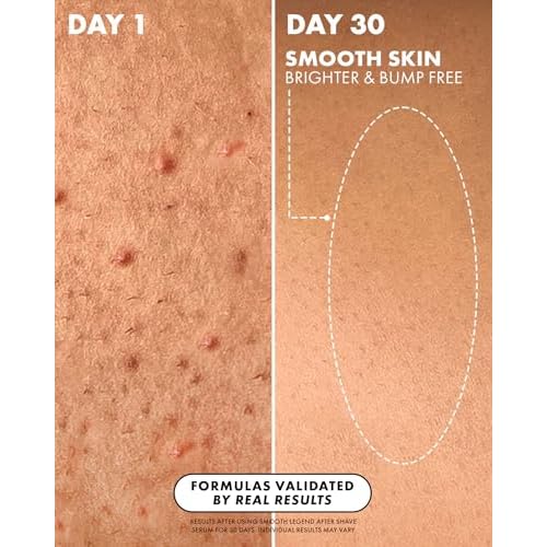 Truly Beauty Luxury After Shave Serum | Soothing & Hydrating Post Shave Treatment to Prevent Ingrown Hair For Smooth, Irritation-Free Skin