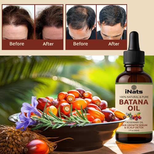 iNats Batana & Rosemary Hair Growth Serum 2 Fl Oz with Organic Ingredients - For Thicker, Longer Hair - Pack of 1