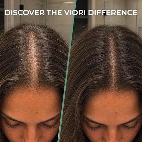 Viori Rosemary Biotin Shampoo Bar for Thinning Hair - Vegan & Sulfate-Free