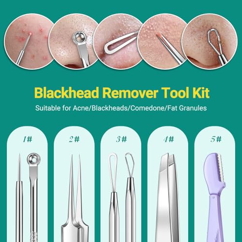 6-Piece Pimple Popper Tool Kit - Blackhead Remover & Extractor Set