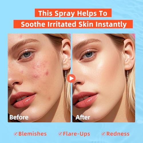 dewyhour Hypochlorous Acid Face Mist - Soothing pH-Balanced Skin Toner