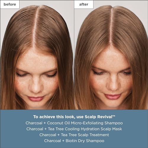 Briogeo Scalp Revival Charcoal + Tea Tree Scalp Treatment | Leave-In Serum for Dry, Flaky, or Itchy Scalp | Hydrating & Balancing | Vegan & Cruelty Free | 1 oz