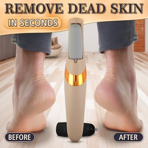 Beige Electric Foot Callus Remover with 2 Speed Modes & Rollers - AZZORI