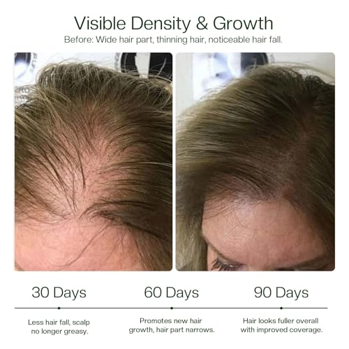 Morovan Hair Growth Spray - 30 Days to Thicker Hair with Batana & Castor Oil