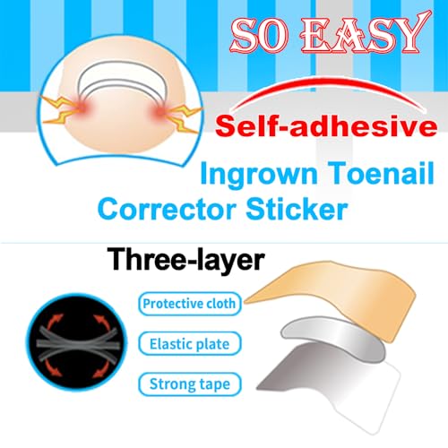 Ingrown Toenail Correction Kit with Nail Clippers & Care Gel - Foot Care Tools