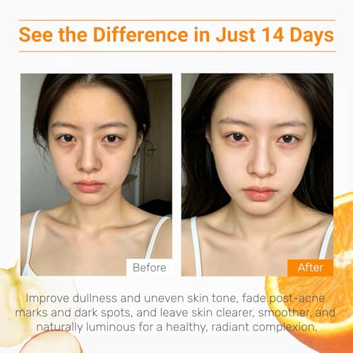 Vitamin C Face Serum for Dark Spots Brightening & Skin Renewal 1 fl oz