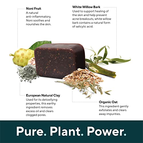 Marie Originals Acne Bar Soap with Bentonite Clay & Oat Bran