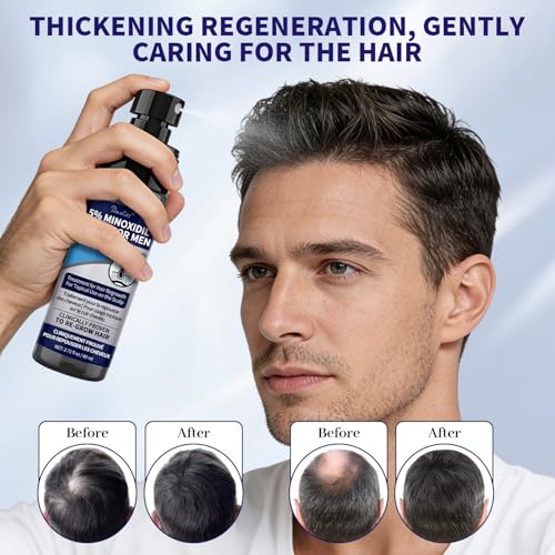 Danliss 5% Minoxidil Hair & Beard Regrowth Spray - 5.42 fl oz (Pack of 2)