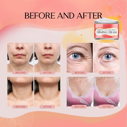Neck Firming Cream with Hibiscus & Honey - Anti-Aging Moisturizer for Fine Lines & Deep Hydration - 1.7 Fl Oz