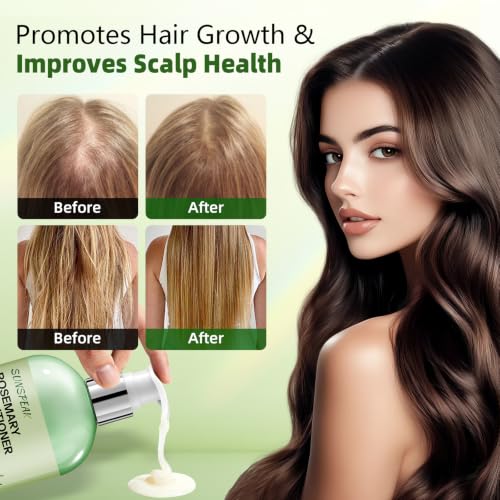 Sunspeak Rosemary Conditioner for Hair Growth & Thinning Hair - Mint & Biotin - For Men & Women - Deep Nourishing & Strengthening - Variation: Rosemary Conditioner