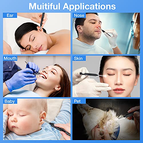 Wireless Ear Wax Removal Camera Kit 1296P HD with 6 Ear Tools & LED Lights
