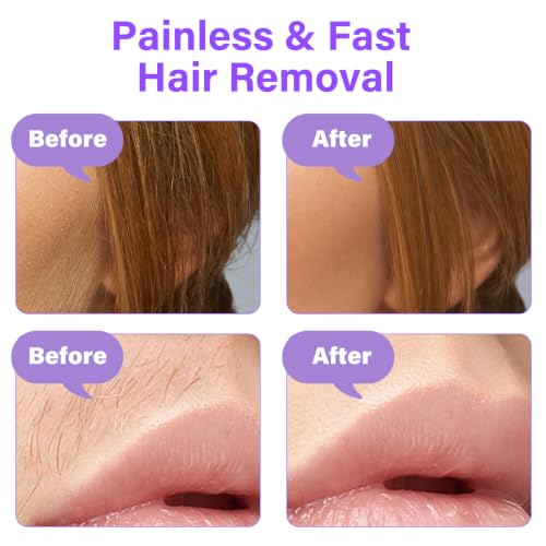 CHOWMI Sensitive Skin Facial Hair Removal Cream - Pack of 2, Includes Soothing Gel