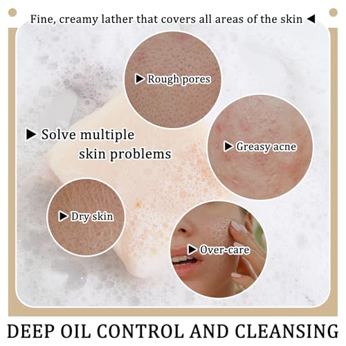 Rice Milk Bar Soap for Face & Body - Hydrating, Deep Cleansing, Oil Control