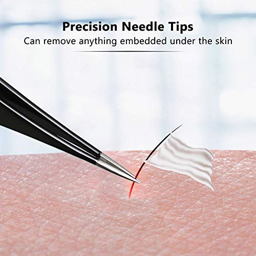 Mudder 3-Piece Stainless Steel Tweezers Set for Ingrown Hair & Eyebrow Grooming