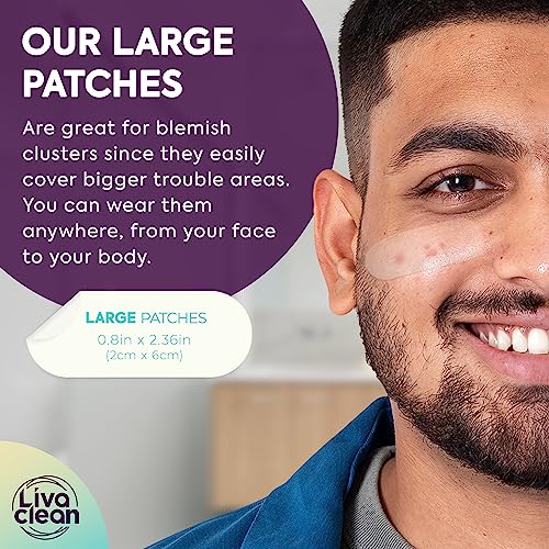LivaClean Large Hydrocolloid Acne Patches - 50CT Zit Patch for Cystic Acne