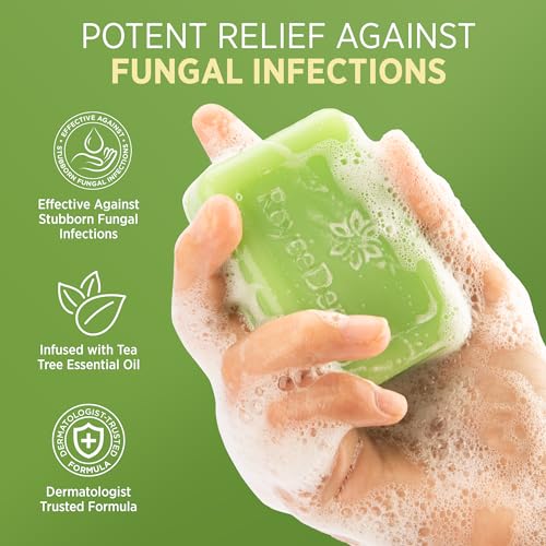 Roycederm Antifungal Bar Soap with Tea Tree Oil - 4 Ounce Pack of 2 for Athlete’s Foot, Jock Itch & Ringworm Treatment