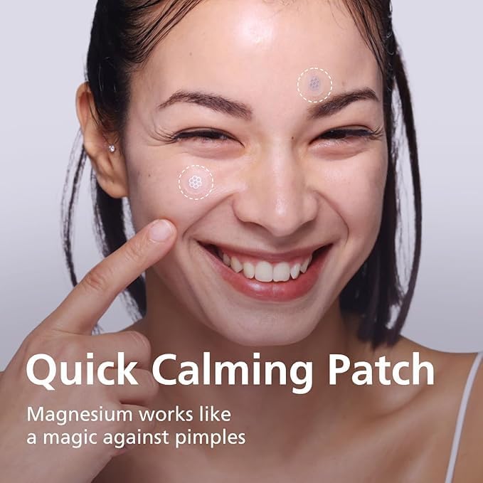 Magnesium Acne Care Patches - Quick Calming Treatment | 30 Individually Wrapped Patches with Tweezers & Ampoule