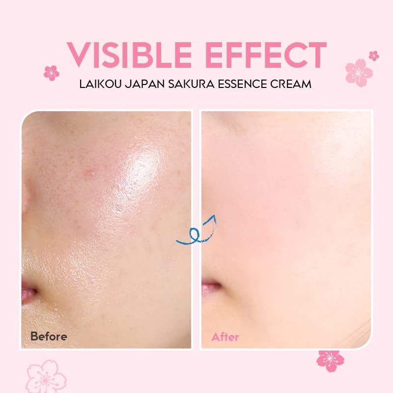 AKARY Vitamin C Serum - Face & Body Moisturizer for Dry Skin