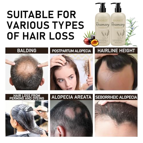 BANKIT Rosemary Batana Shampoo for Thinning Hair with Biotin & Keratin